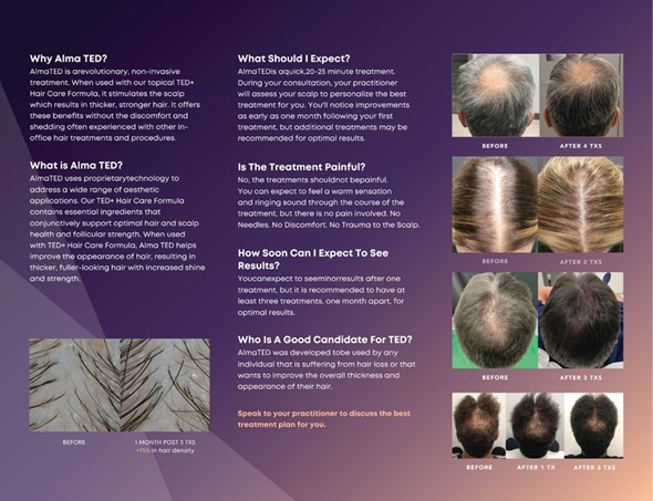 Hair rejuvenation results with Alma TED and Nutrafol