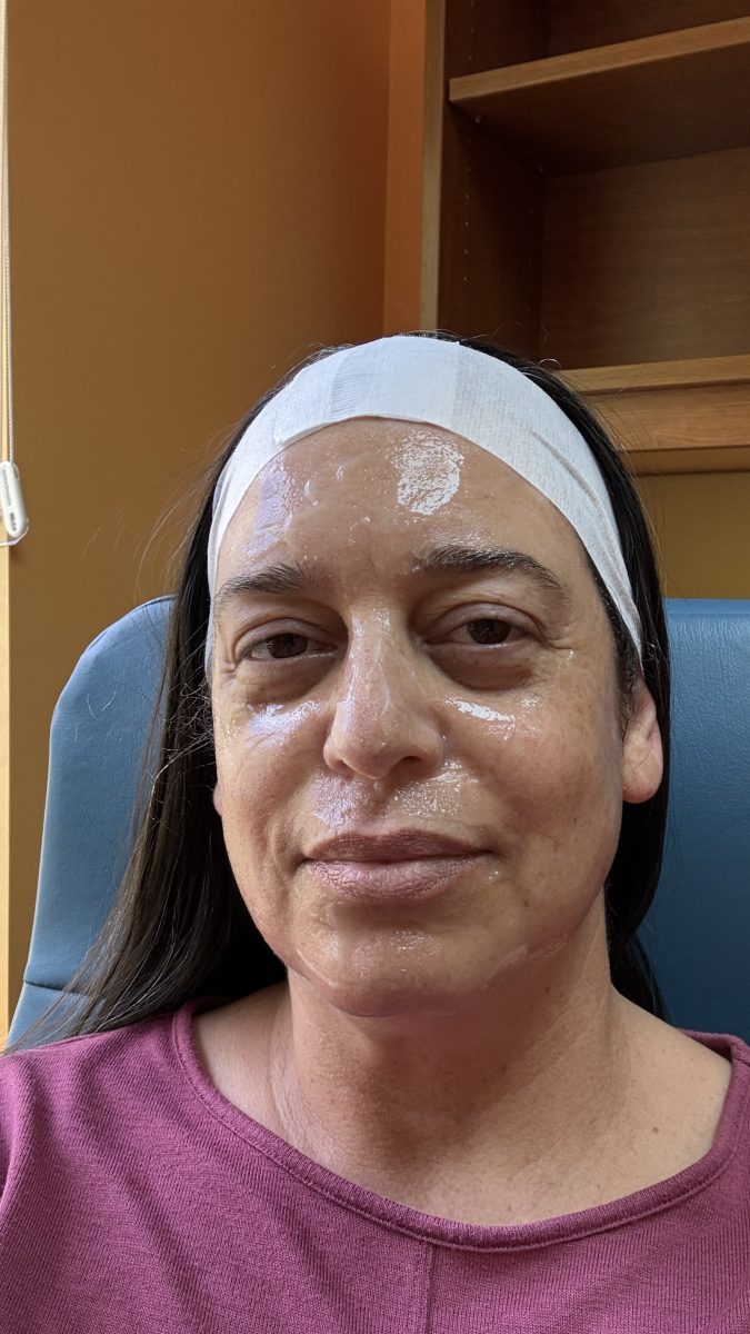 How Hormones Affect Your Skin — And What BocaMed Can Do About Hormone Imbalance Skin Aging in Boca Raton