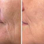 Anti-Ageing Therapies in Boca Raton: A Step-by-Step Guide to Looking and Feeling Your Best
