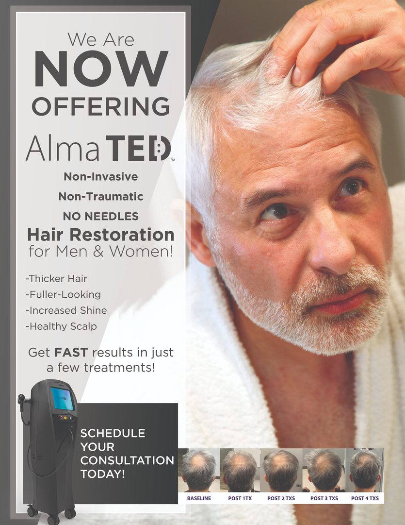 Restore Fuller, Healthier Hair with AlmaTED in Boca Raton
